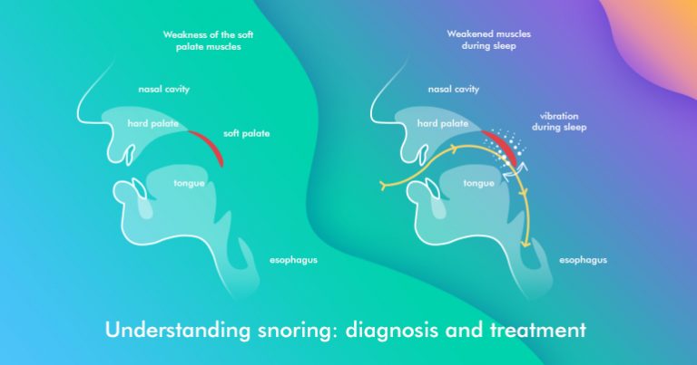 Understanding snoring: diagnosis and treatment